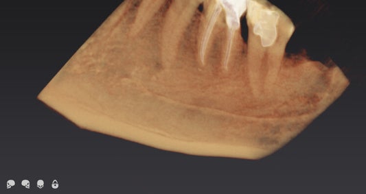 CBCT foto 3D kaak