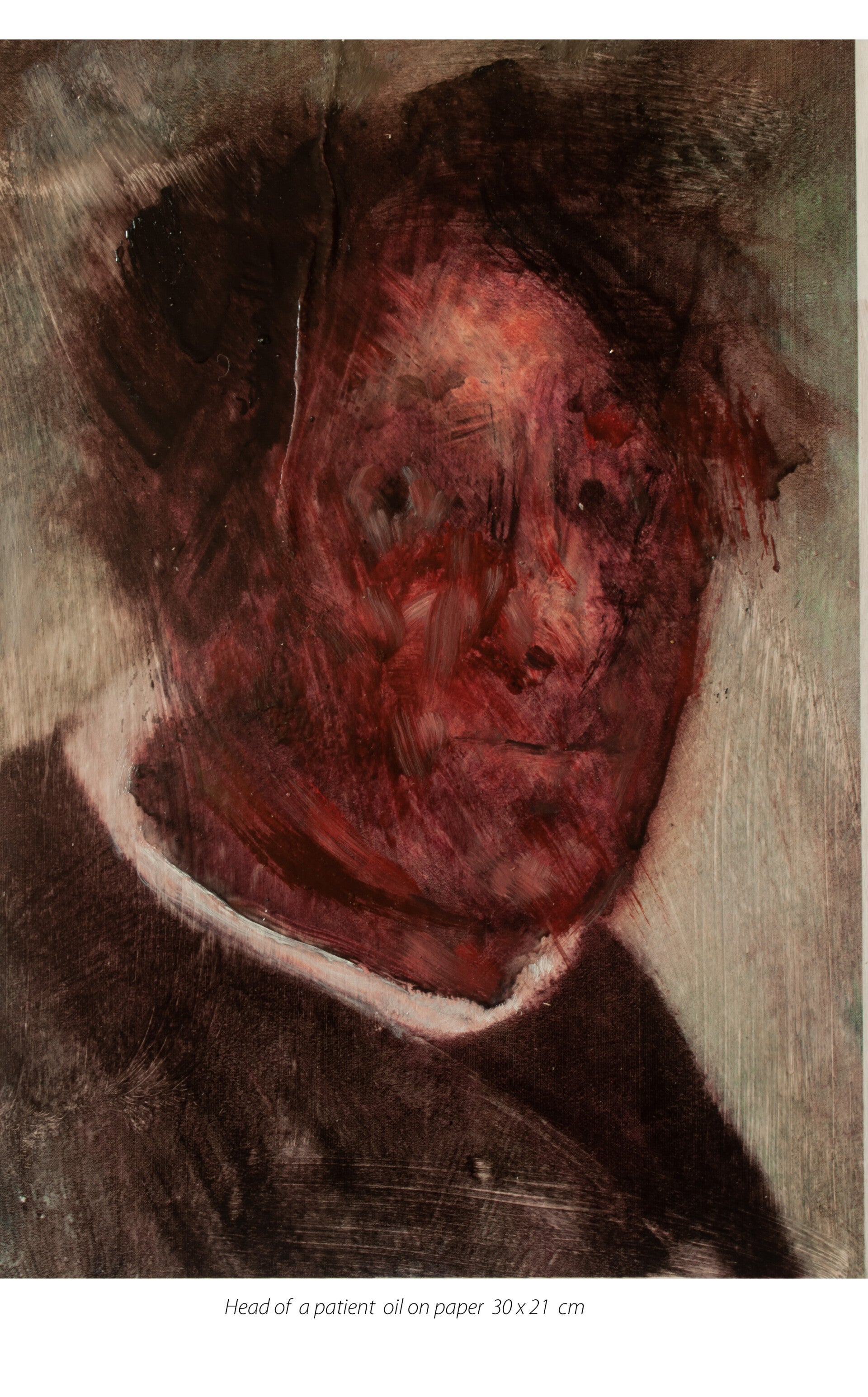 Head of a patient