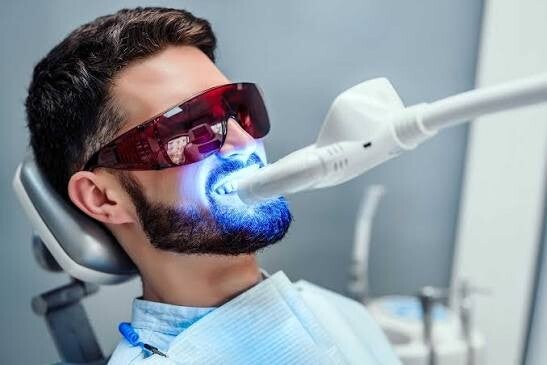 Laser teeth whitening