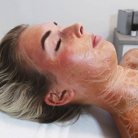 BioPulse behandeling Sneek