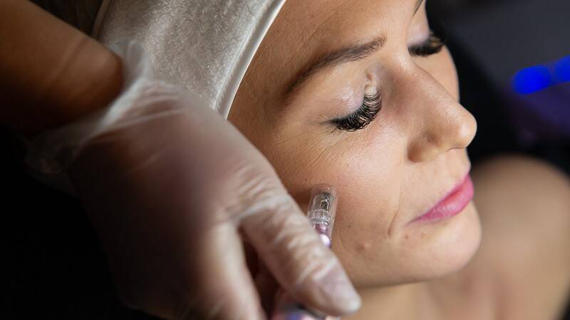 Microneedling PUUR Fiona Sneek