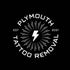 Plymouth Tattoo Removal