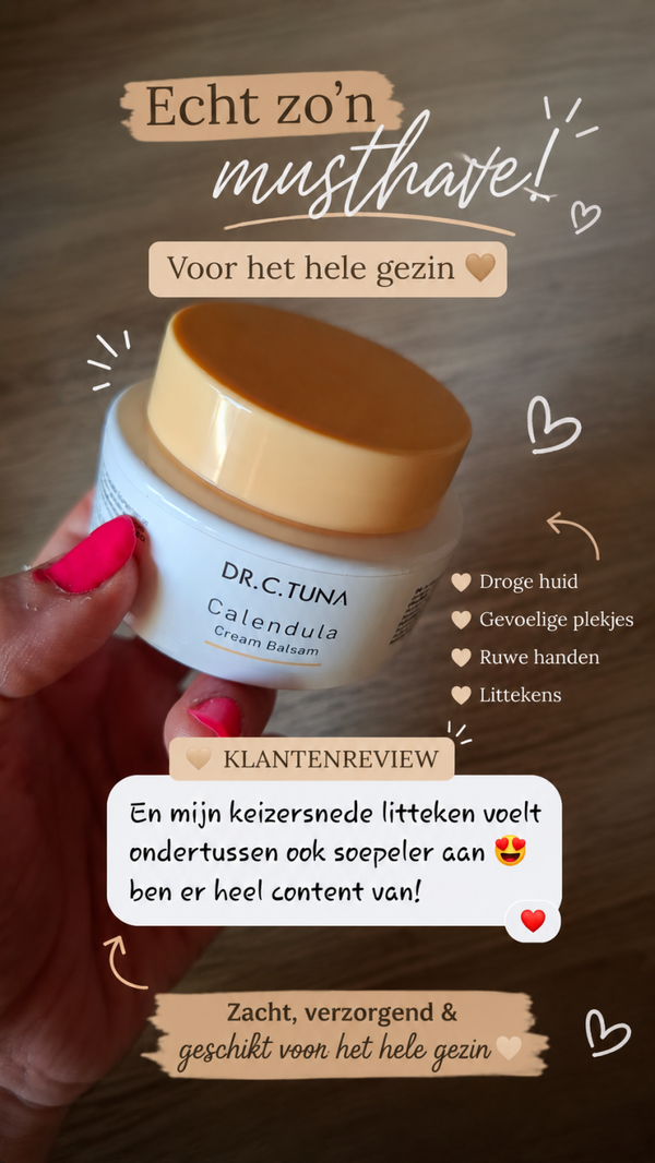 Calendula balm