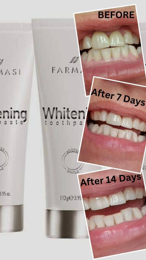 Whitening tandpasta
