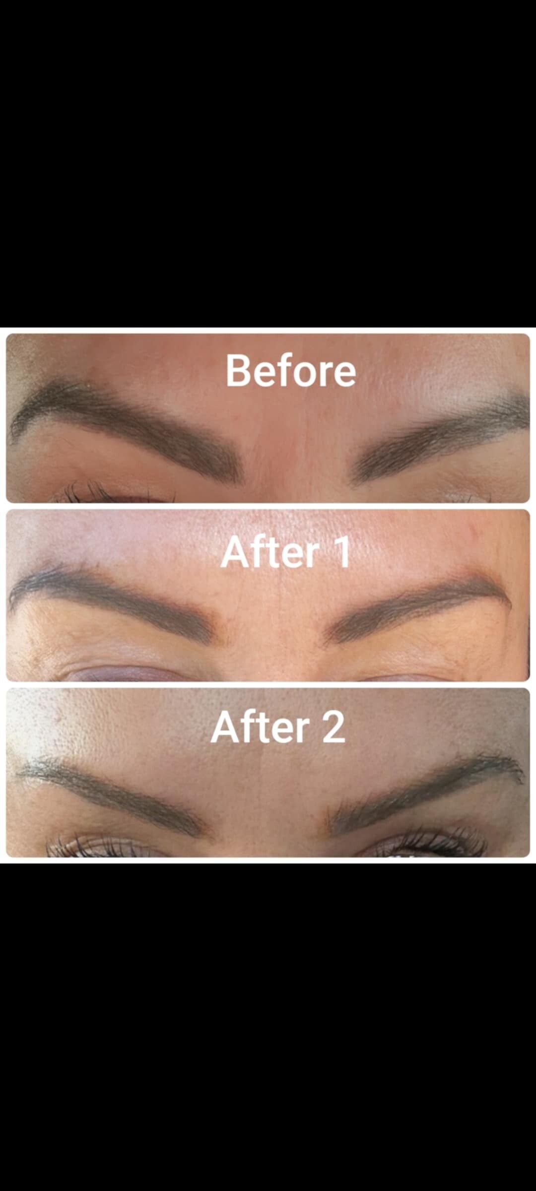 brow-reshape-3-standard.jpg