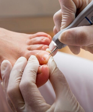Met een gespecialiseerde medische pedicure houdt je je voeten gezond en kan je pijnlijke voeten verlichten