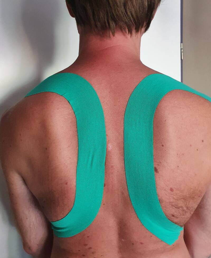 Medical taping Hooikoortstaping Hooikoortsklachten