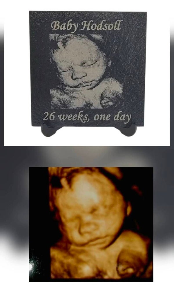 BABY SCAN PHOTO ENGRAVED ONTO SLATE PLAQUE 4D ULTRASOUND 12 WEEKS AND MORE
