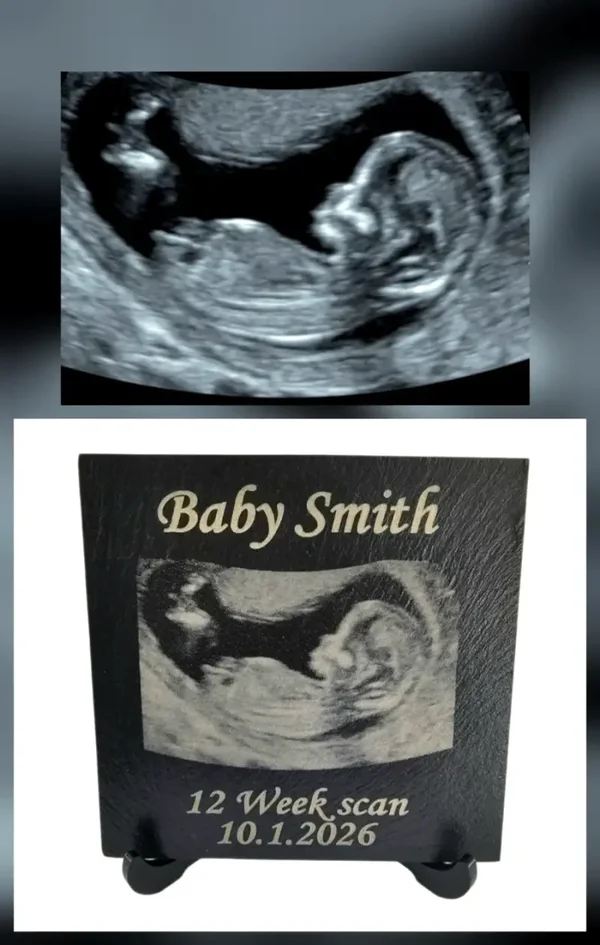 Personalised New Baby scan Ultrasound photo Mum to be gift Pregnancy keepsake