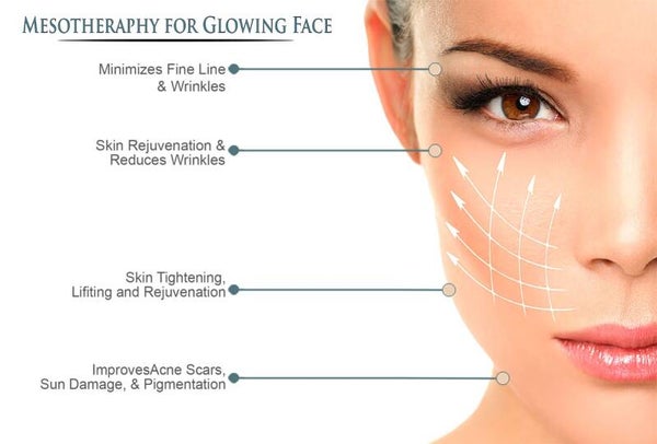 Face mesotherapy