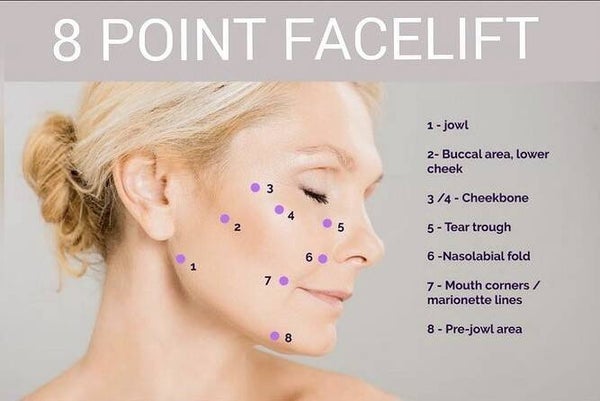 Anti-wrinkle 3 areas+ 3 ml Dermal filler