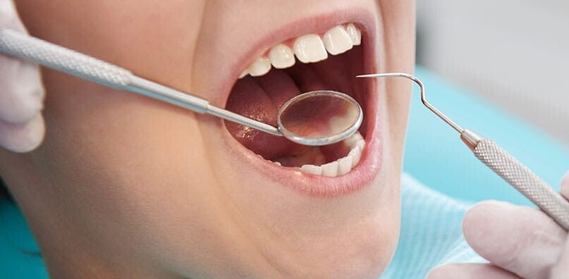 alt"=photo bouche ouverte et inspection visuelle " "