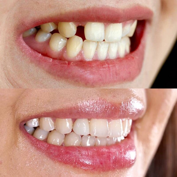 Fix Your Teeth & Smile Spell Casting Dental Health Beauty Ritual Wicca Pagan