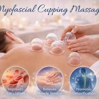 Cupping at SAI Massage and Wellness in Calgary