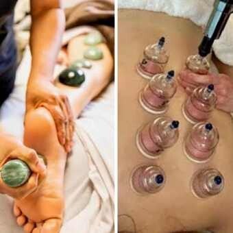 Cupping + Hot Stones at SAI Massage and Wellness in Calgary