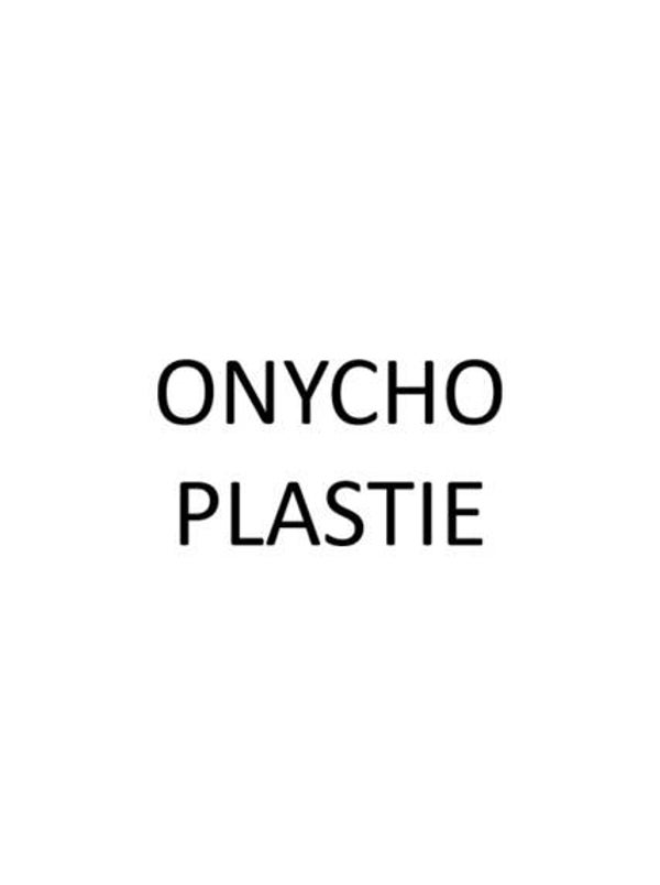 Onychoplastie (prothèse d'ongle)
