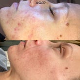 fawn-before-and-after-2-standard-r2dlvr.jpg