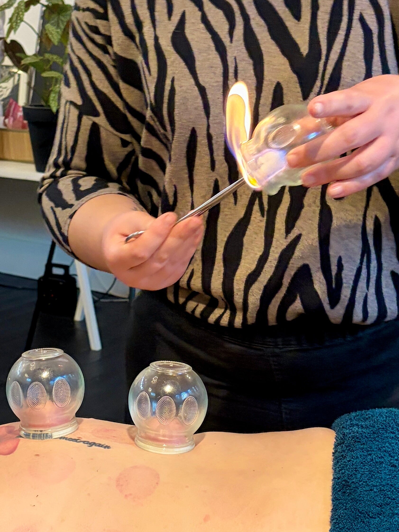 Cupping praktijk cupping en meer Almere