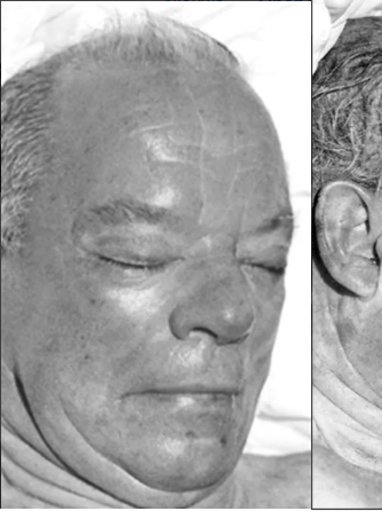 Ongeidentificeerde Doden Stichting Coldcasezaken ongeidentificeerde-doden-stichting-coldcasezaken