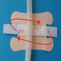 fixierset-lumina-anwendung-1.jpg