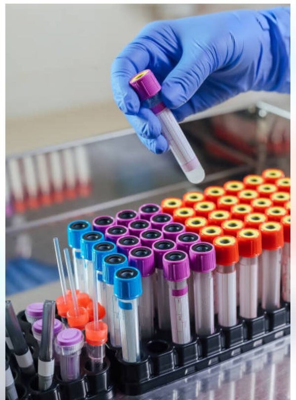 Single Tube Blood Collection Only