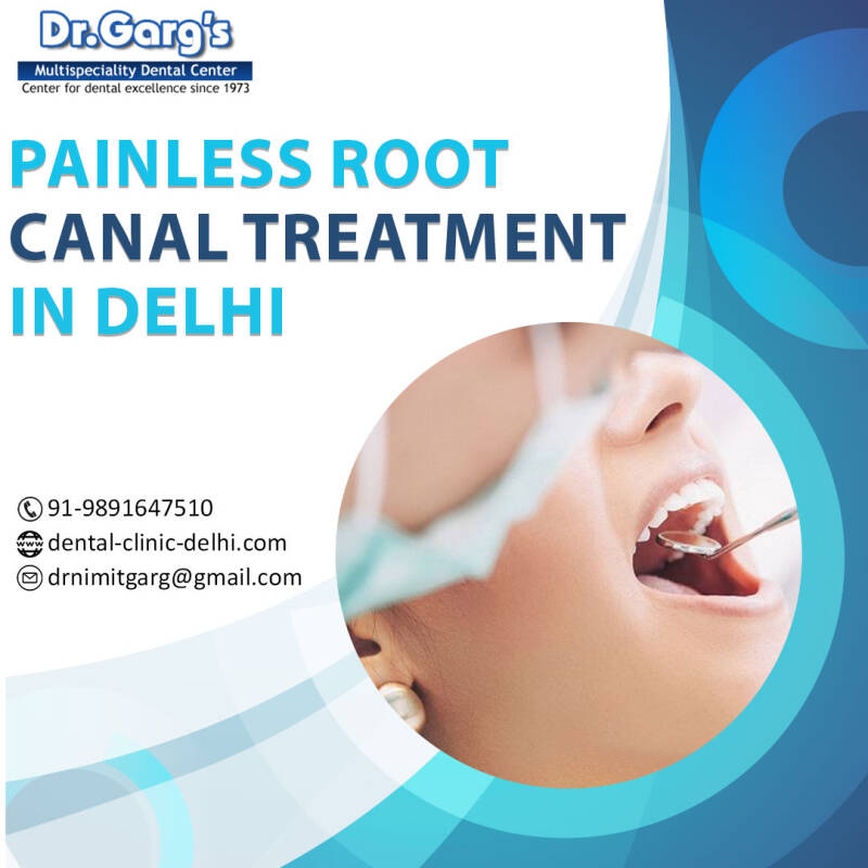 root canal treatment cost in Delhi