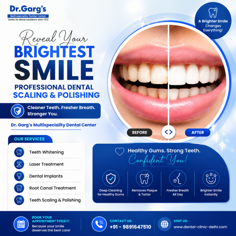 Improve your oral hygiene with safe and effective teeth scaling and polishing treatment in Rajouri Garden, Delhi.