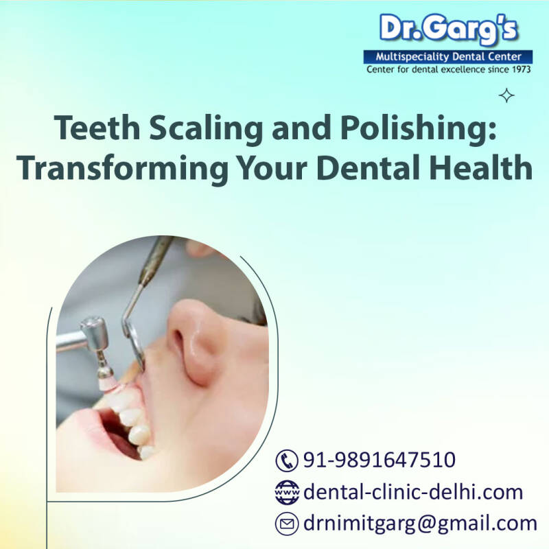 Teeth Scaling and Polishing