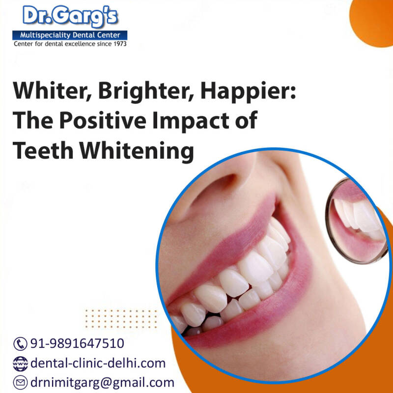 Zoom whitening