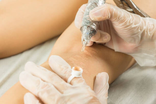 Scar camouflage tattoo