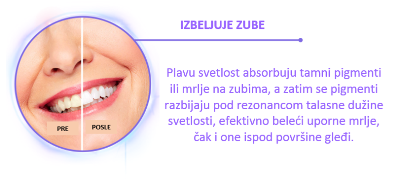 Hit u Holivudu - Inovativno fototerapijsko pranje i beljenje zuba u Vašoj kući