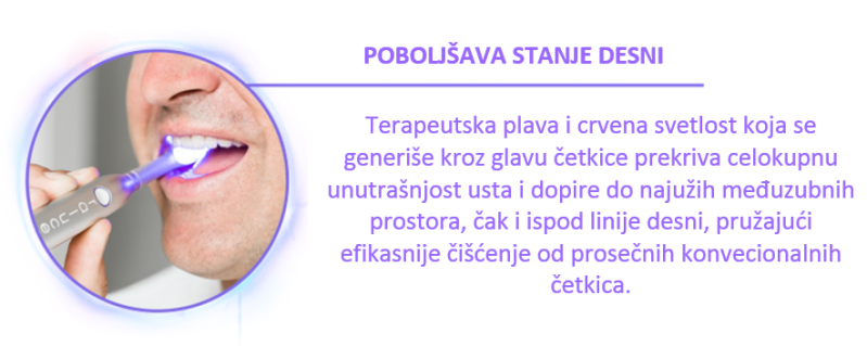 Hit u Holivudu - Inovativno fototerapijsko pranje i beljenje zuba u Vašoj kući