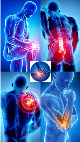 Arthrites, sciatalgie, cervicalgie, épondyltie, facsites, capsulite,