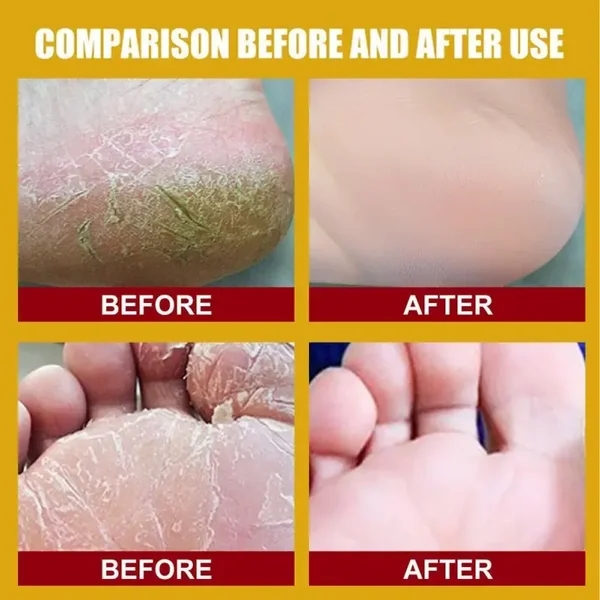 CRÈME RÉPARATRICE INTENSE Pieds très secs & abimés 75ml