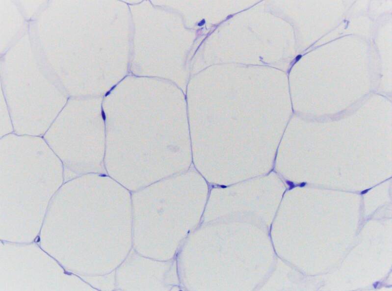 Fat cells