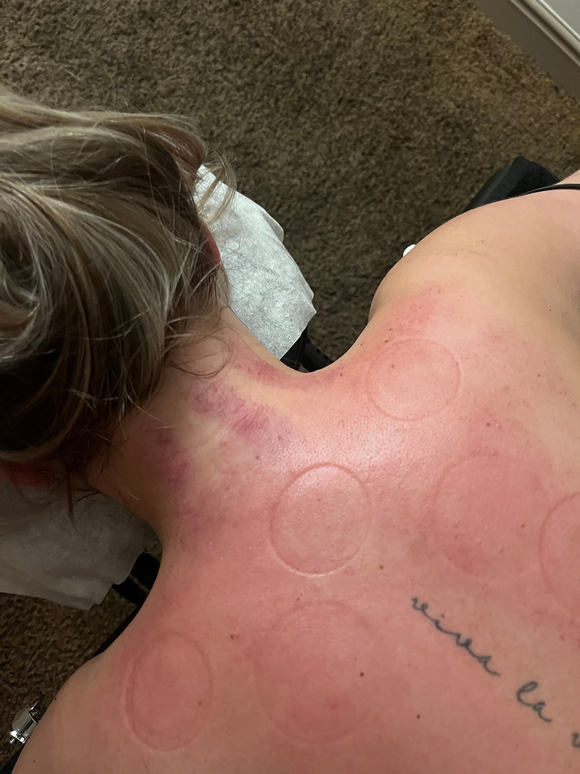Transformational cupping in Herpen