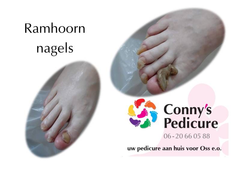 Ramhoornnagels