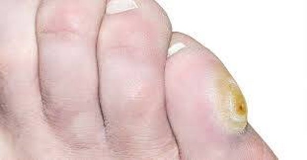 Pedicure deelbehandeling (20 minuten)