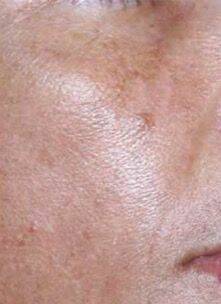 Schoonheidsbehandeling