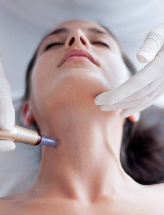 Microneedling Den Bosch