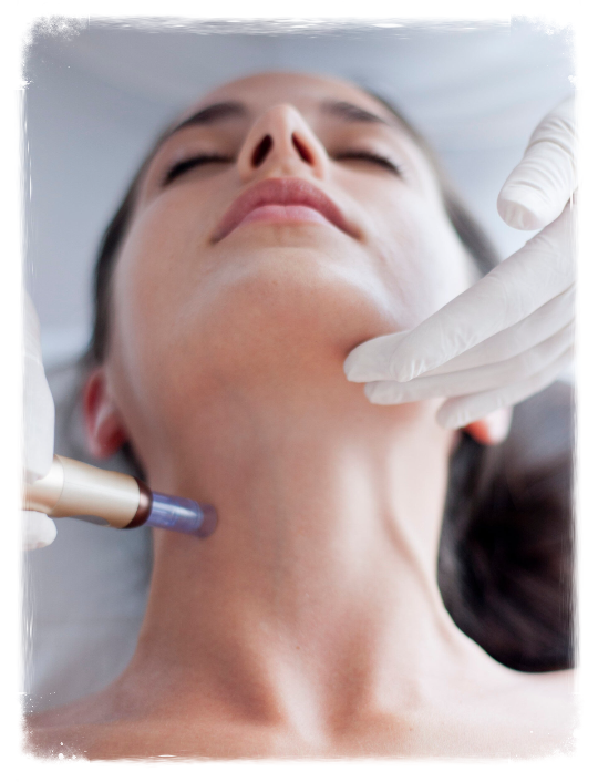 Microneedling Den Bosch