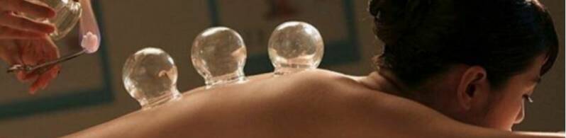 Acupunctuur Lisse Cupping-