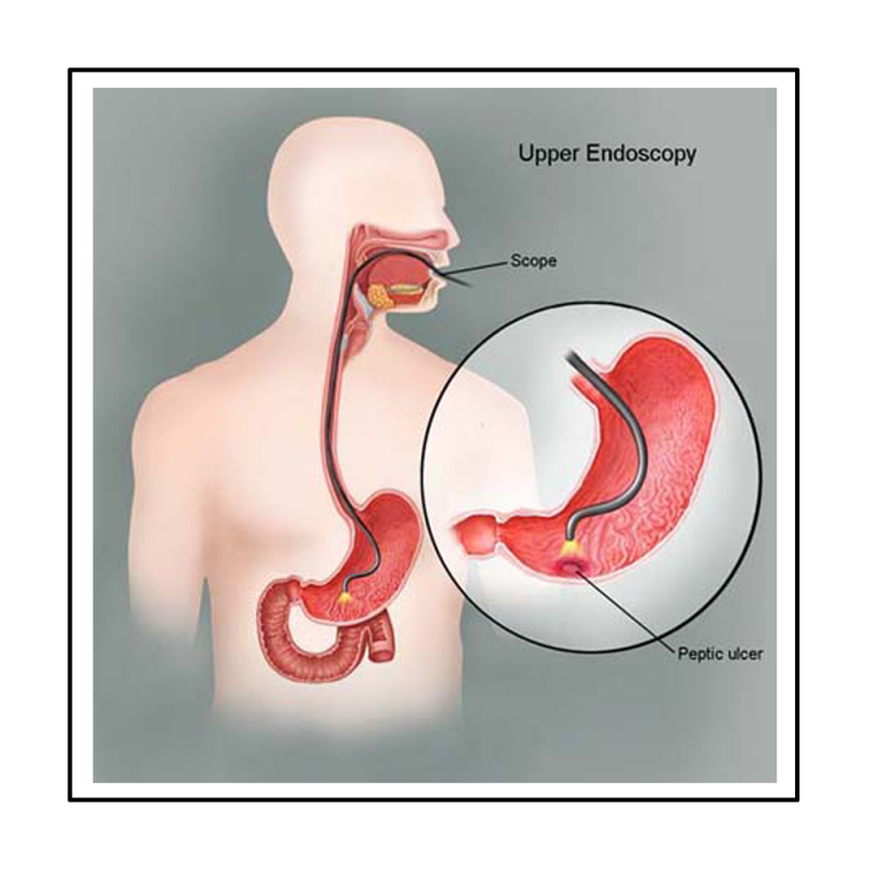 Portfolio category: Digestive system and gastroenterology illustrations