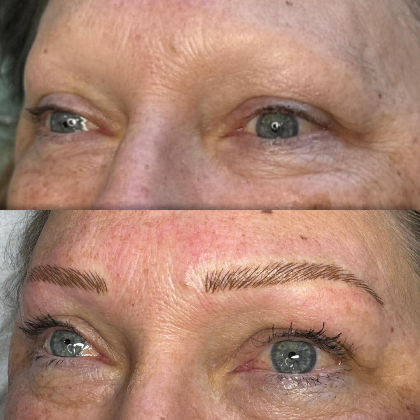 Cosmetic Tattooing