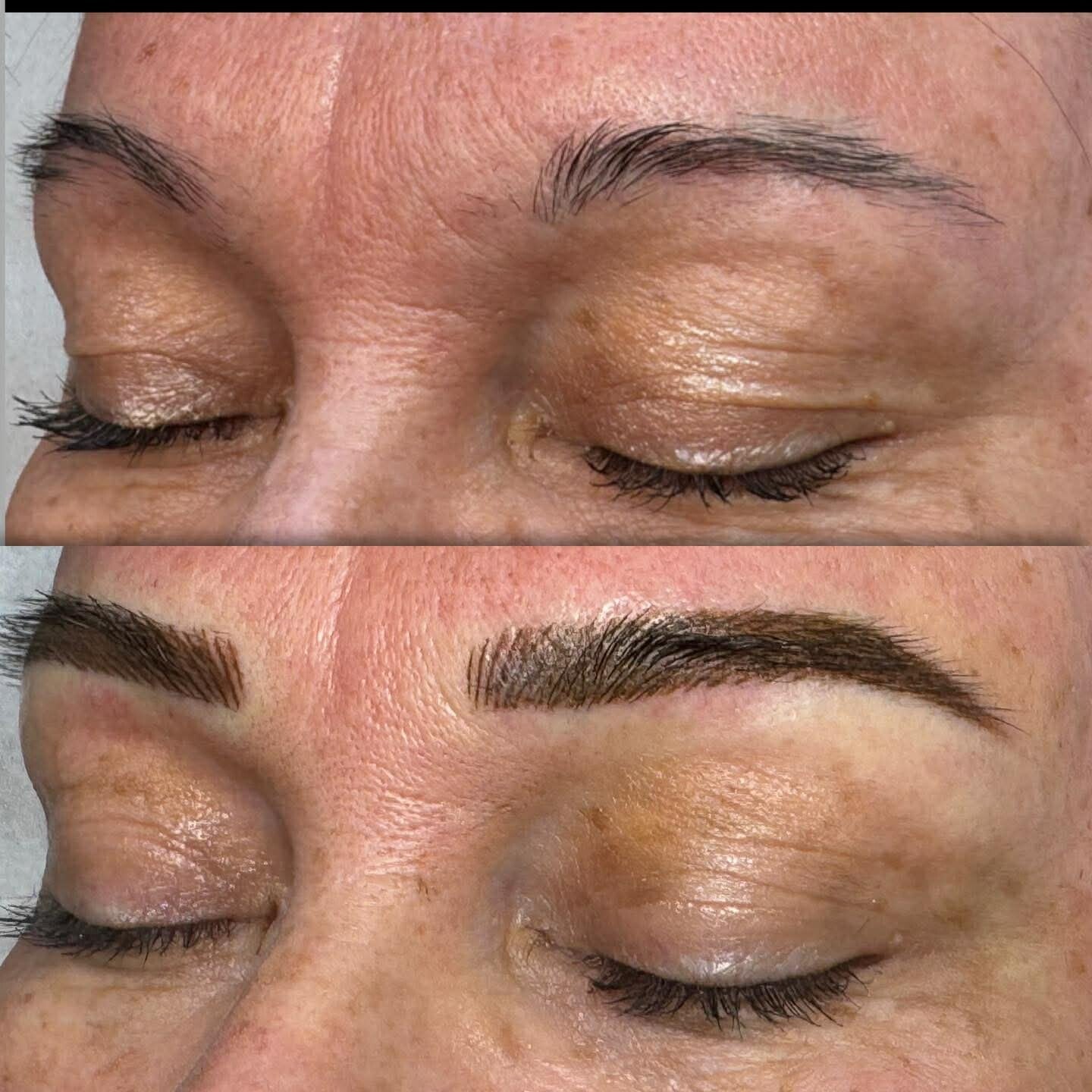 Cosmetic Tattooing