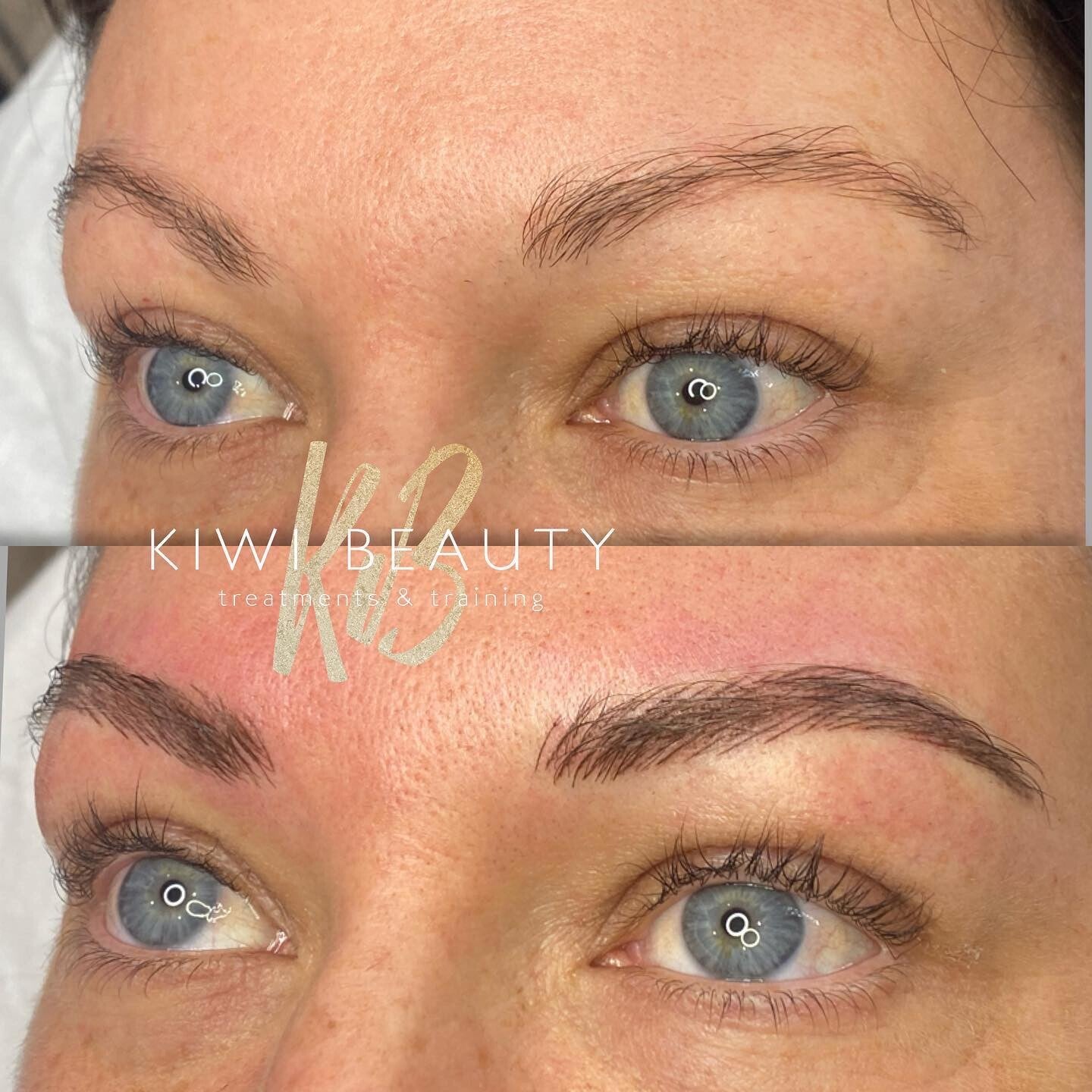 Cosmetic Tattooing