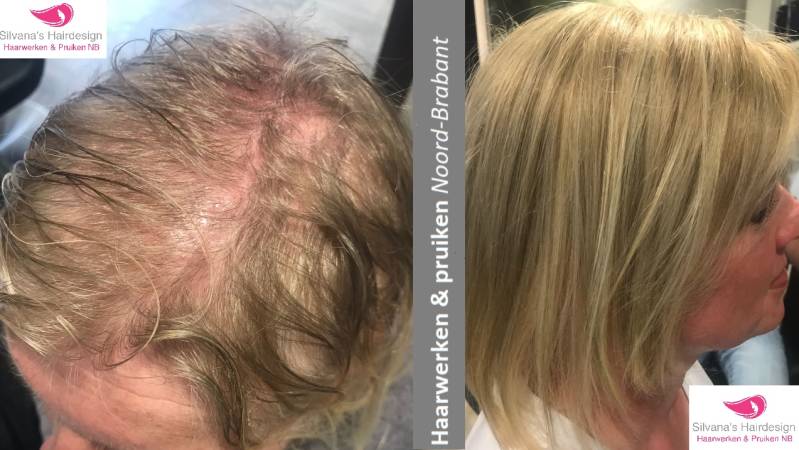 Resultaat van een klant met een haarstuk T-Parting