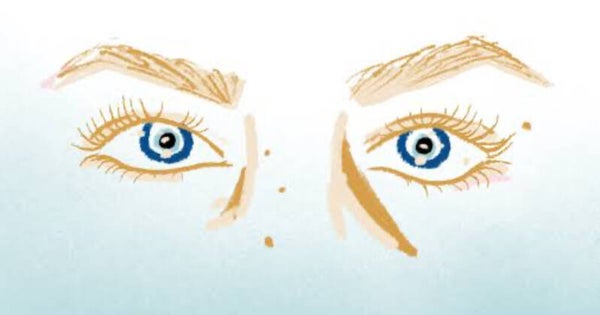 Evil Eye Removal
