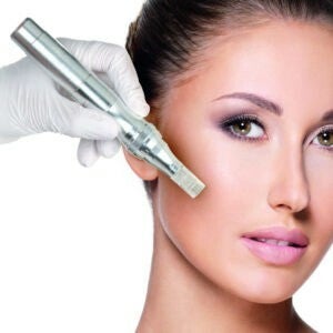 Microneedling