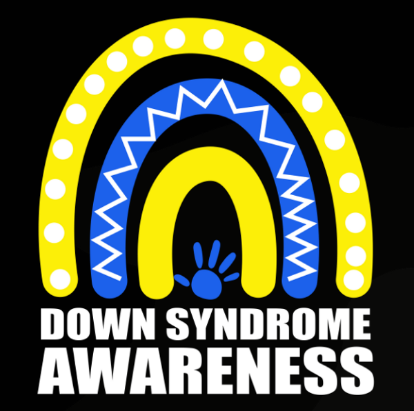 Down Syndrome 2